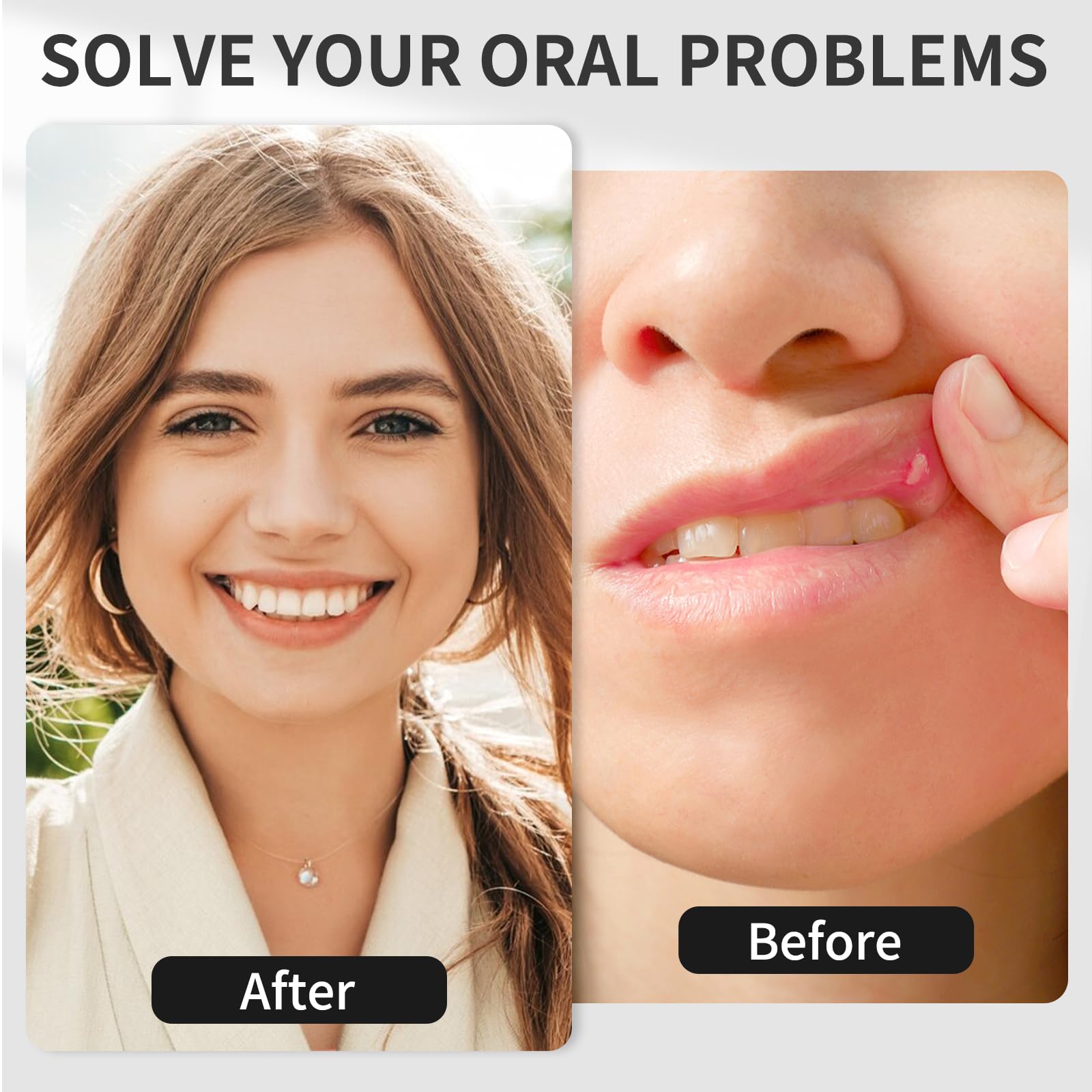 KTS® Red Light Oral Therapy Device