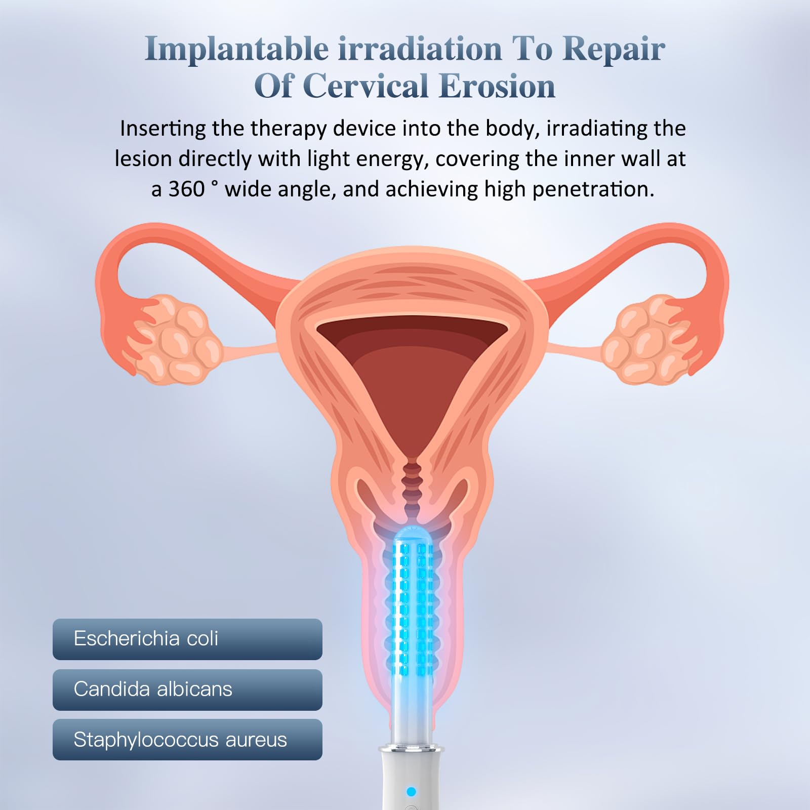 KTS® Portable Vaginal Rejuvenation Wand