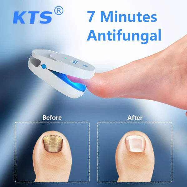 KTS® Nail Fungus Laser Treatment Device