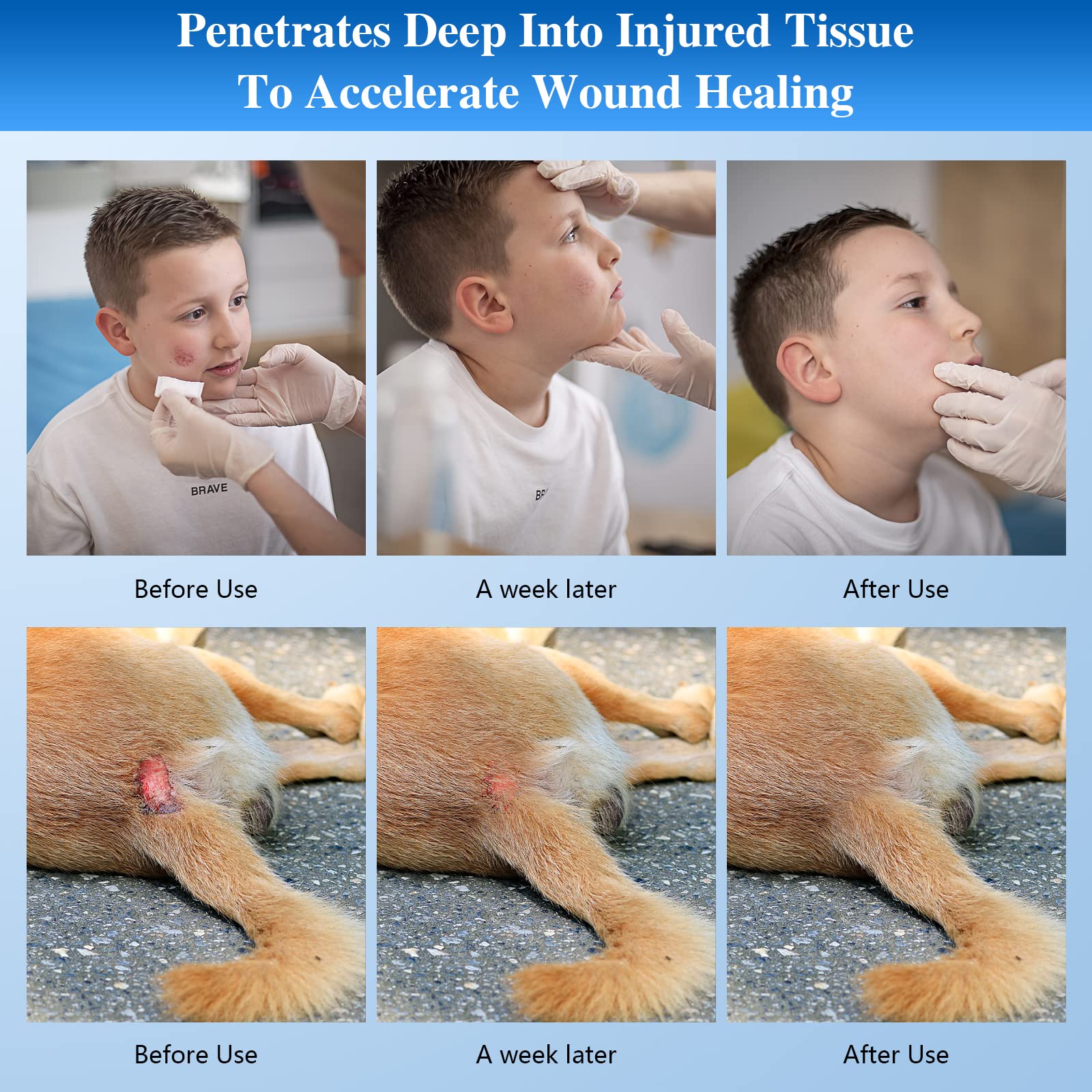 KTS® Red Light Therapy Flashlight for Face