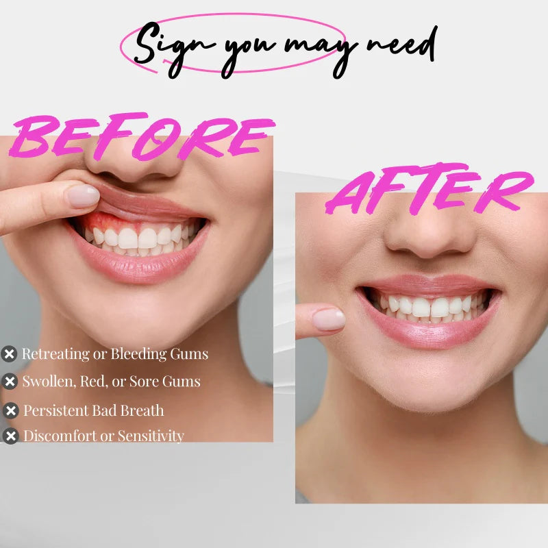 Red & Blue Light Therapy For Gums