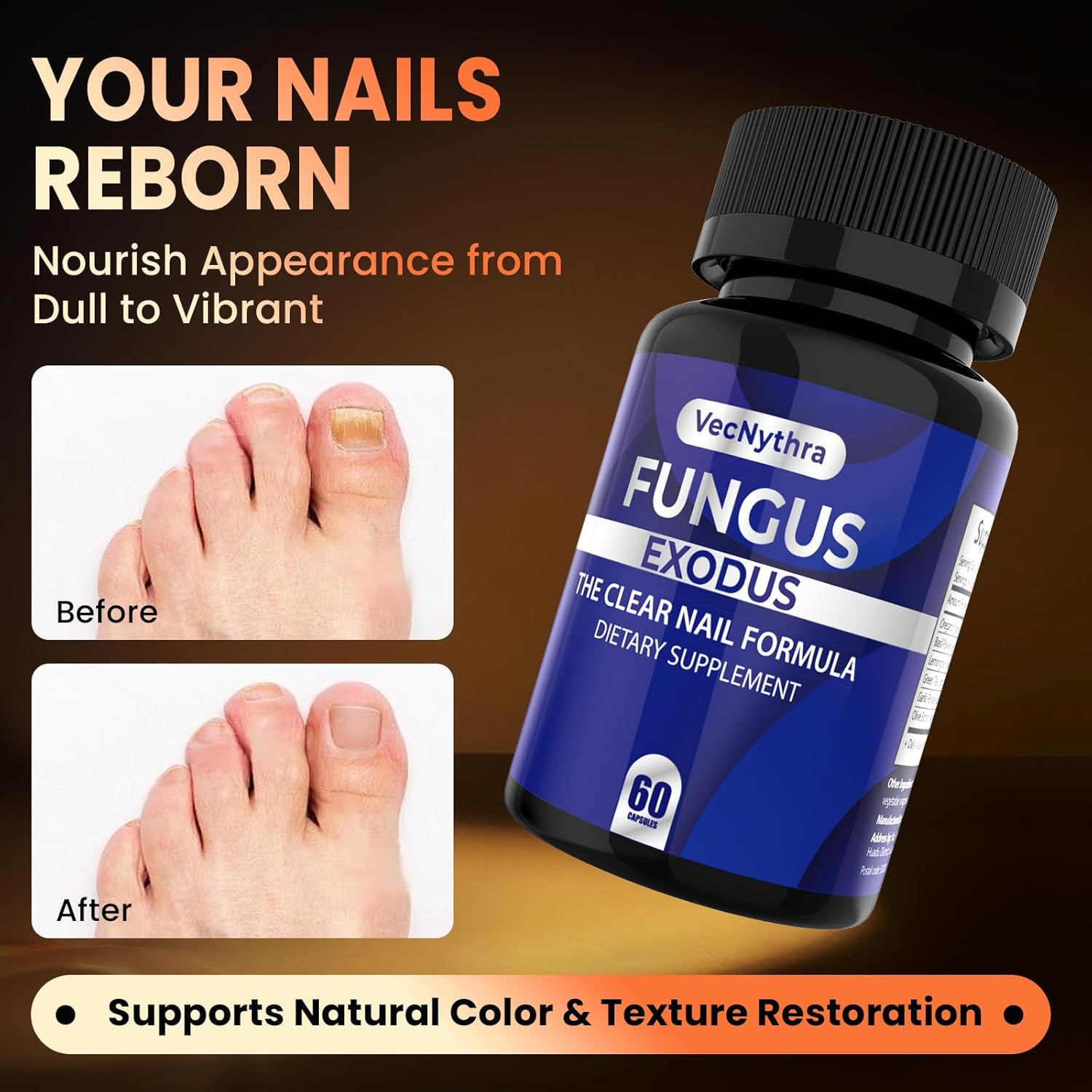 Fungus Exodus - Probiotic Fungus Inhibitor Capsules