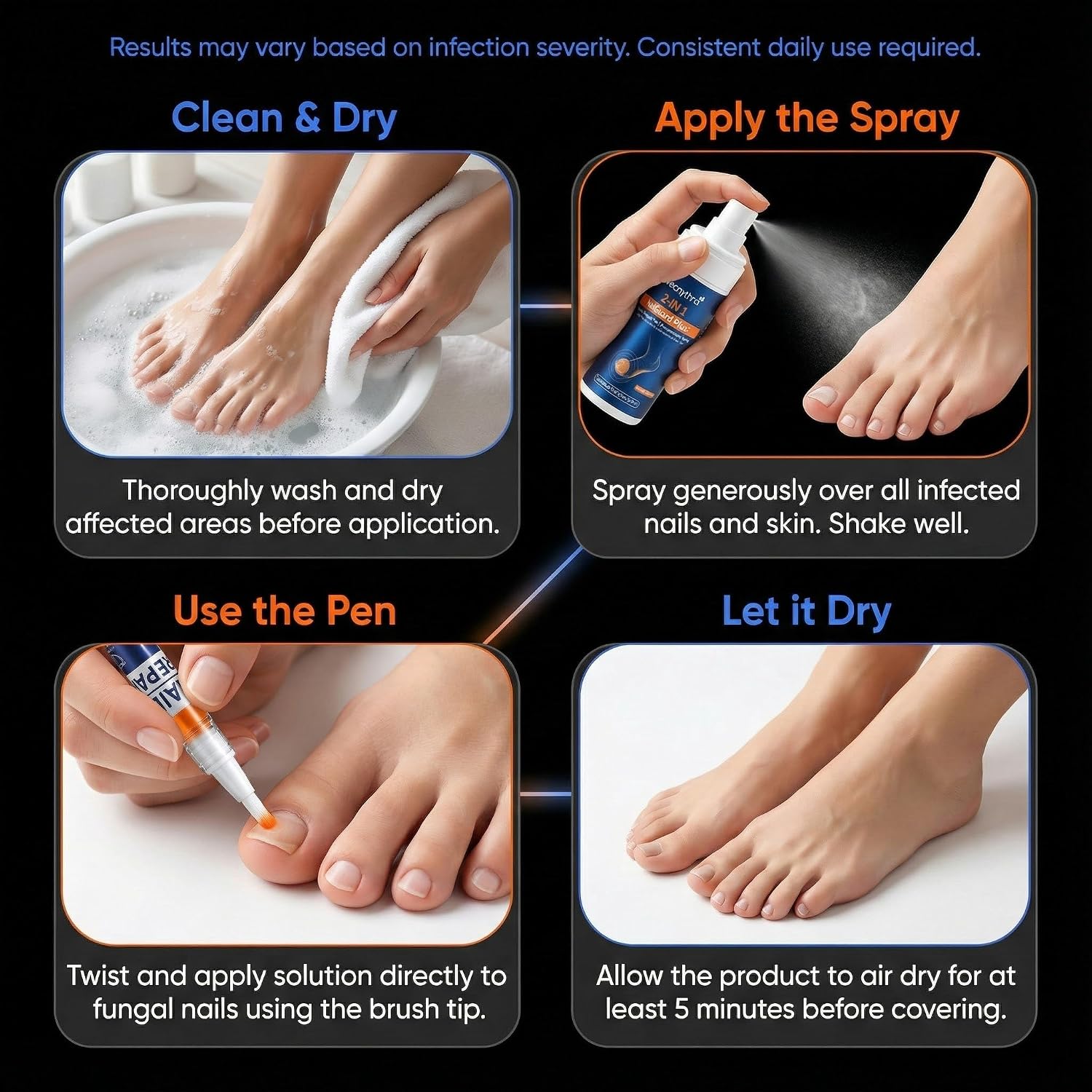 KTS Athlete’s Foot Spray & Toenail Fungus Pen Set