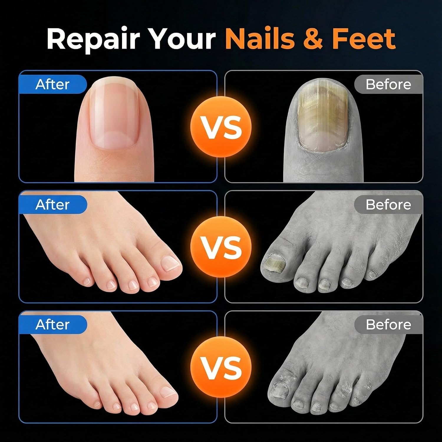 KTS Athlete’s Foot Spray & Toenail Fungus Pen Set