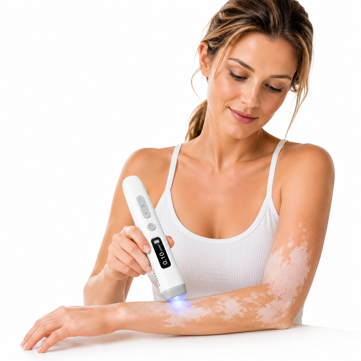 2026 New KTS Handheld 308nm UVB Light Phototherapy Device