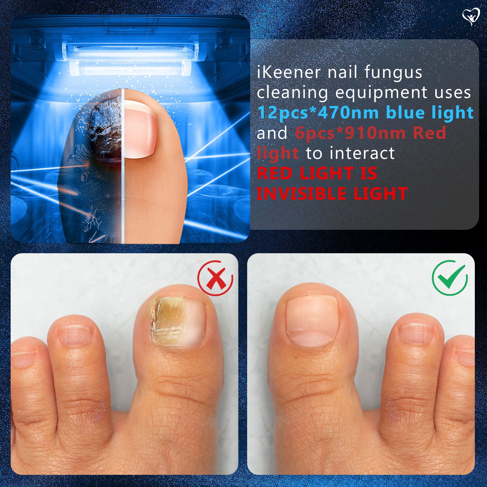KTS Nail Fungus Light for Multiple Toenail