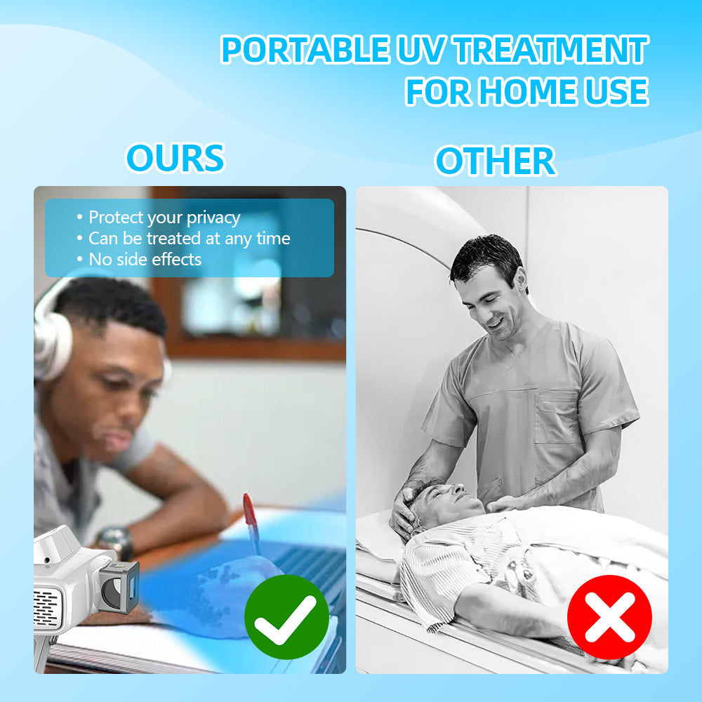 UVB Vitiligo/Psoriasis Light Therapy Device for Home