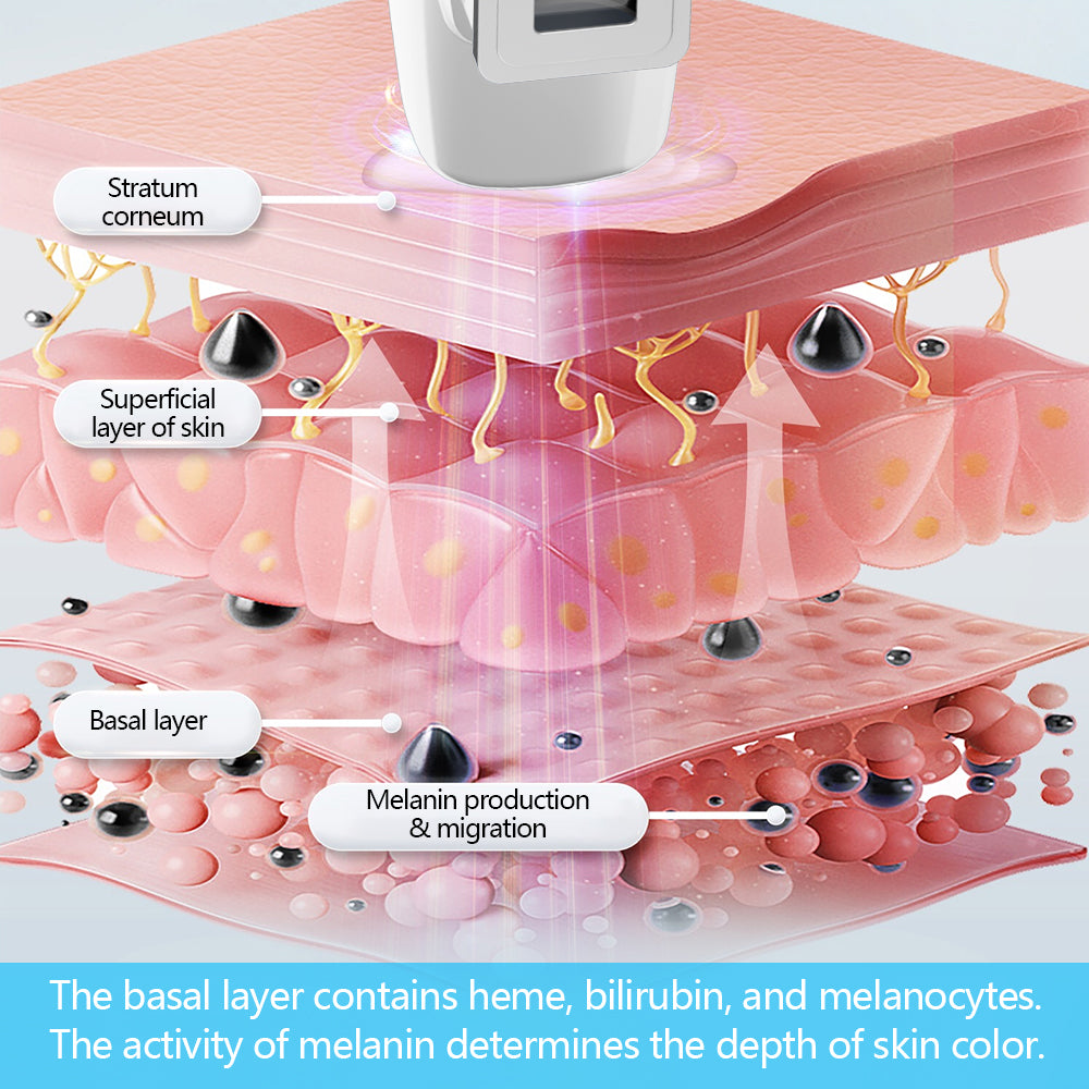 UVB Vitiligo/Psoriasis Light Therapy Device for Home