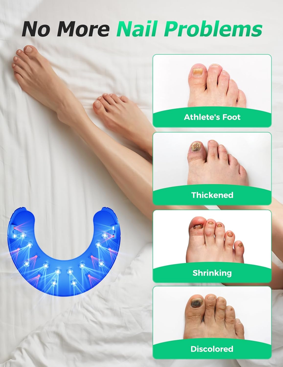 Wireless Nail Fungus Laser Treatment Devices for Multiple Toenails