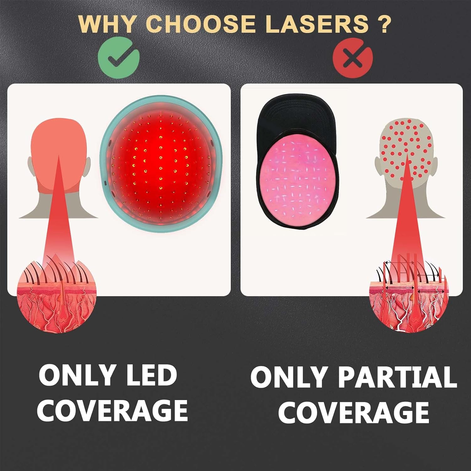 KTS® Hair Regrowth Treatments Laser Cap