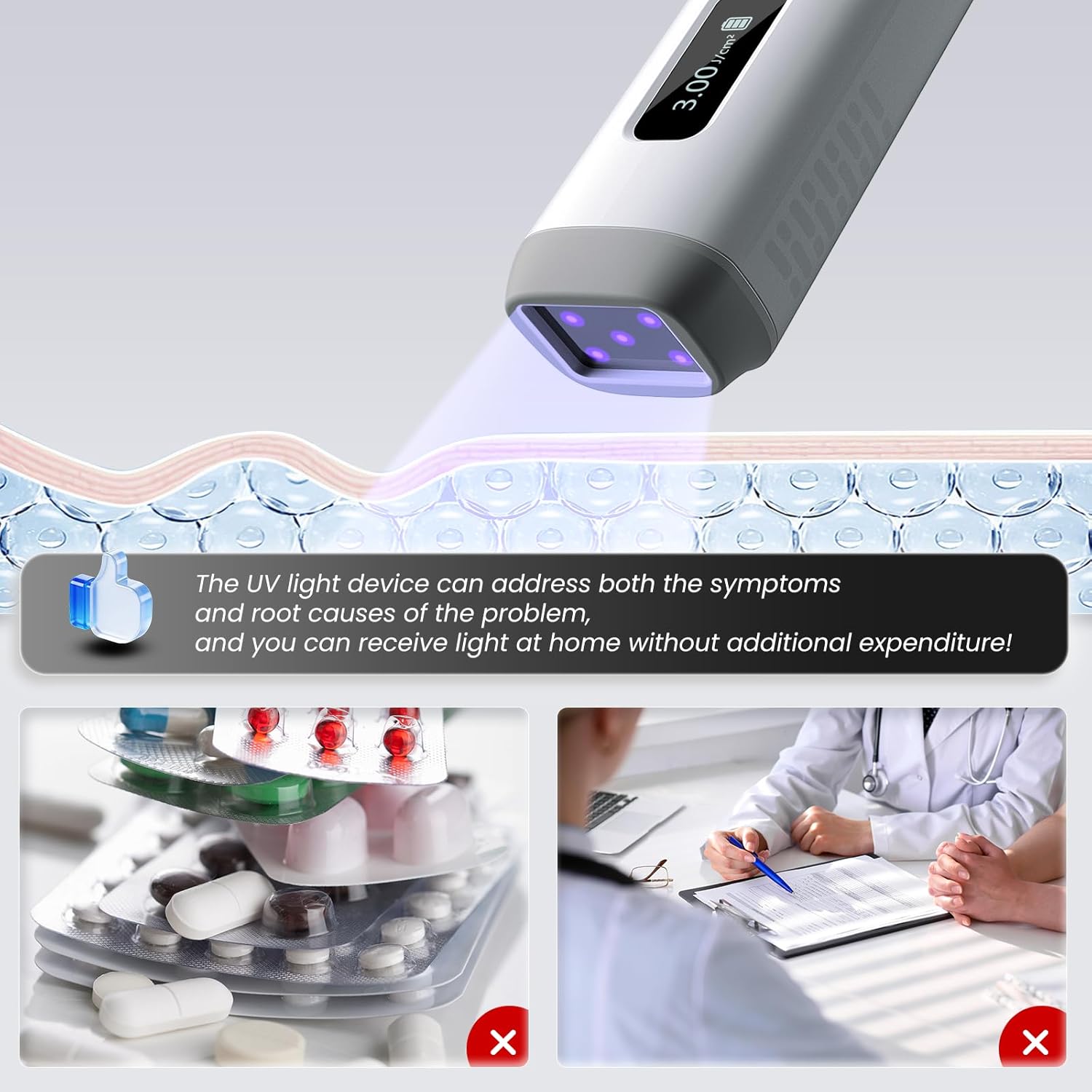 2026 New KTS Handheld 308nm UVB Light Phototherapy Device